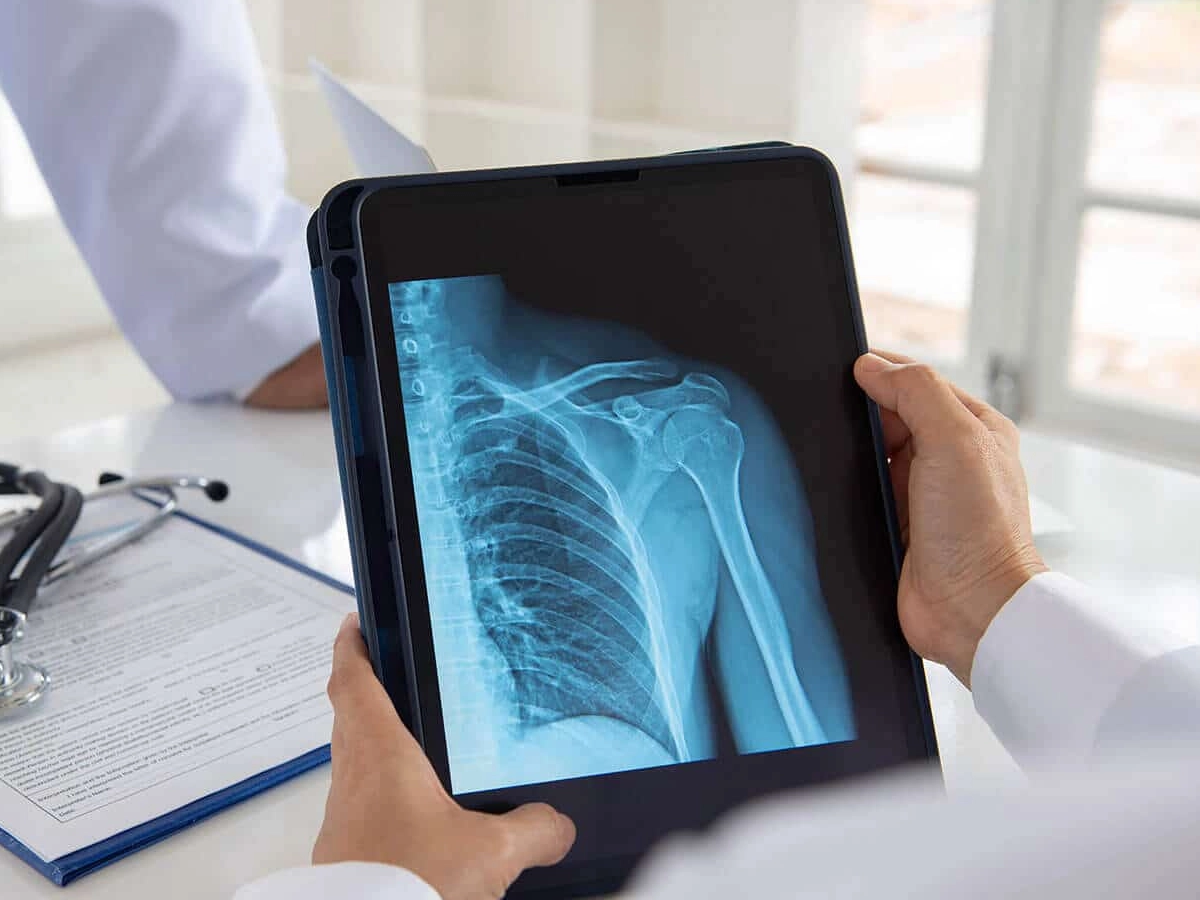 Exame de Raio X / Radiografia